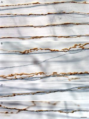 Commentary: Phase-amplitude coupling at the organism level: The amplitude of spontaneous alpha rhythm fluctuations varies with the phase of the infra-slow gastric basal rhythm